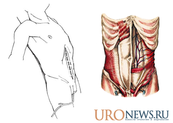 Fascia transversalis мышцы живота