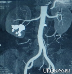 Рис. 2. Мультиспиральная компьютерная томограмма органов брюшной полости.