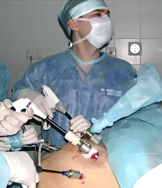 Лапароскопия - важен возраст хирурга
