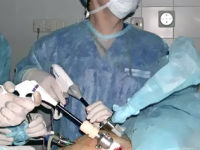 Лапароскопия — важен возраст хирурга!