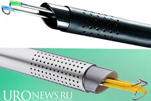 ТУР простаты, какая методика безопаснее: биополярная или монополярная