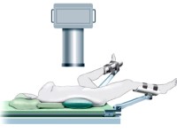 Положение больного на операционном столе при чрескожной нефролитотрипсии (ЧНЛТ): мета-анализ.