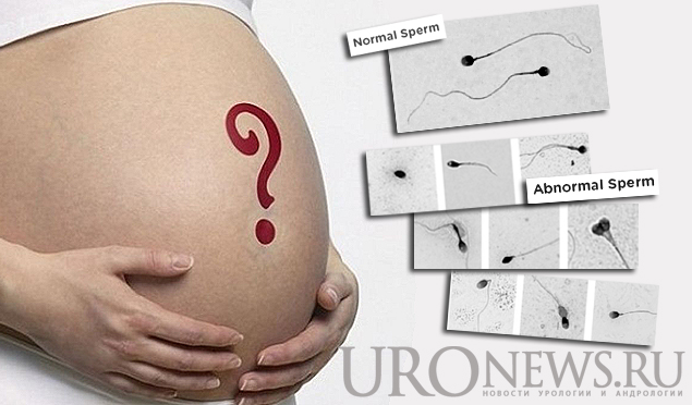 морфология сперматозоидов влияет на беременность