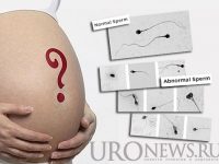 Влияние морфологии сперматозоидов на вероятность невынашивания беременности